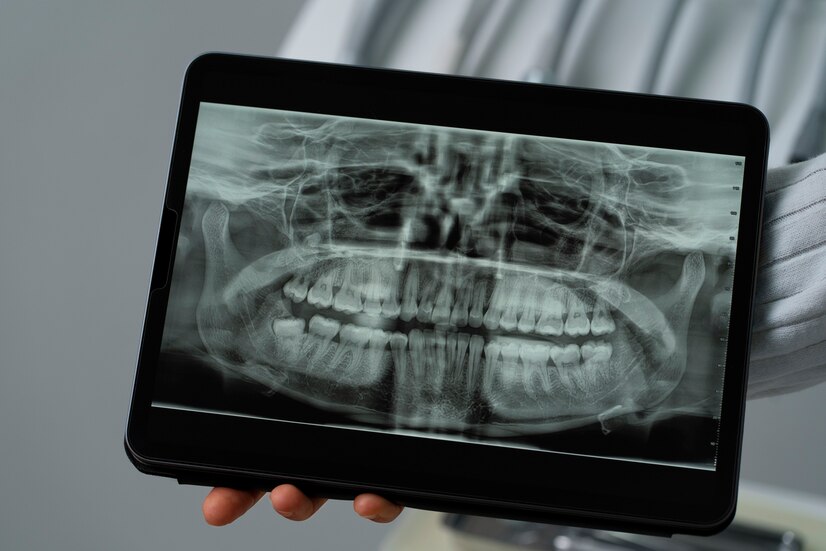 XRAYS / IMAGING